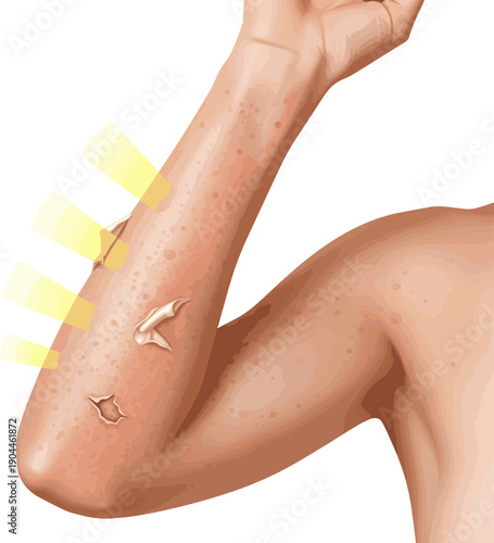 Isolated a realistic Sunlight damages unprotected skin, causing dullness and sunburn effects vector art white background.