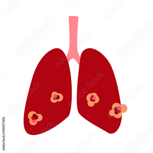 cancer tumor cell developing concept