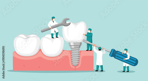 Dental Implant Procedure. Tooth Restoration. Medical Illustration. Flat Design.