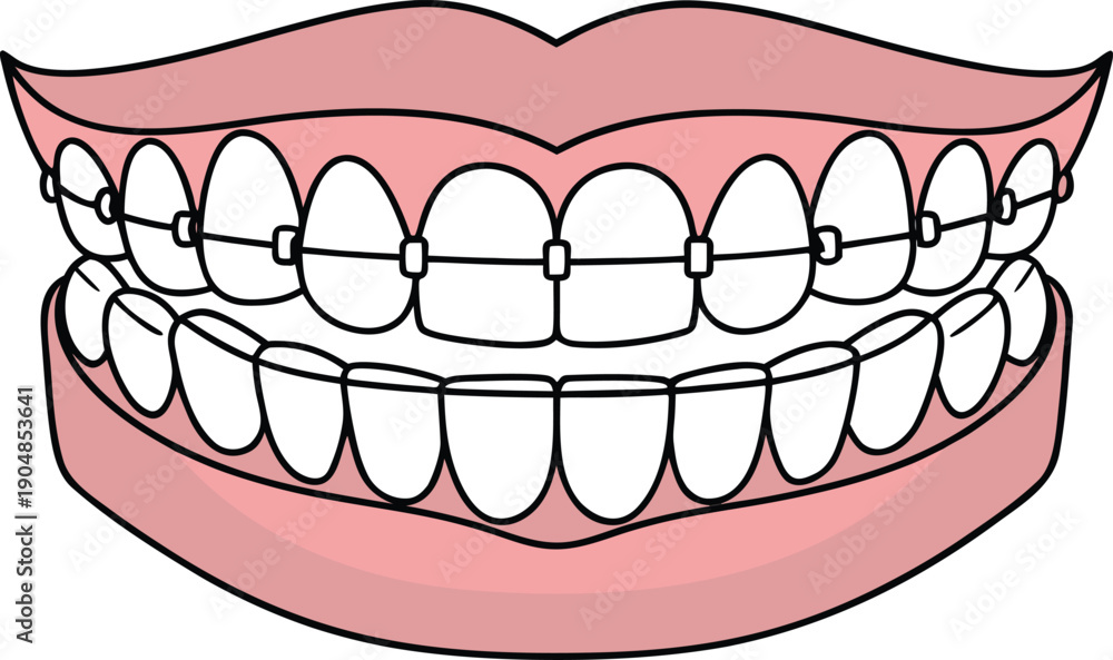 Obraz premium Orthodontics Dental Care Illustration. Dental Braces Treatment Illustration. Orthodontic Teeth Alignment Illustration. Modern Orthodontics Dental Illustration. Dental Clinic Orthodontics Illustration
