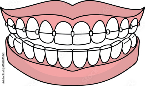 Orthodontics Dental Care Illustration. Dental Braces Treatment Illustration. Orthodontic Teeth Alignment Illustration. Modern Orthodontics Dental Illustration. Dental Clinic Orthodontics Illustration