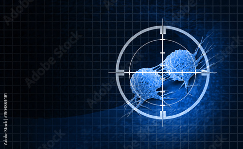 Wallpaper Mural Oncology Cancer Treatment Medical Science fighting Cancer and malignant tumors with surgical removal or radiation treatment to eliminate cancerous cells as a symbol of Immunology with immunotherapy or Torontodigital.ca