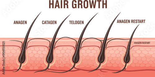 Medical illustration of hair growth cycle showing anagen, catagen, telogen, and restart phases in cross‑section skin view for dermatology and cosmetology education.
