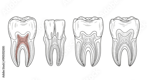 Detailed illustrations of four human molar teeth with internal anatomy visible