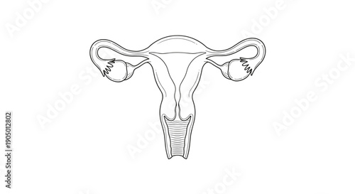 Detailed anatomical illustration of a female reproductive system focusing on the uterus and ovaries