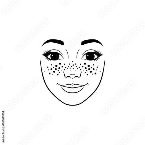 Womans Face with Freckles and Acne.
