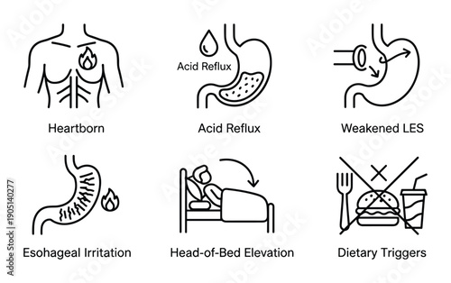 Acid Reflux Line Art: Heartburn, Irritation, Weakened LES, Head Elevation, and Dietary Triggers