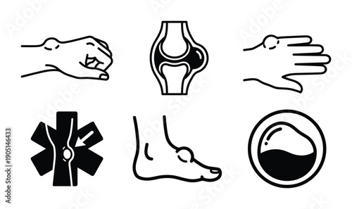 Ganglion cysts icons set. Hand, wrist, foot, knee cyst medical diagram vector illustration