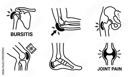 Joint Pain and Bursitis Line Art Illustrations of Shoulder, Elbow, Hip, Knee, Ankle, Bones