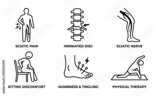 Sciatic Pain Illustrations Set: Herniated Disc, Sciatic Nerve, Sitting Discomfort, Tingling, Physical Therapy