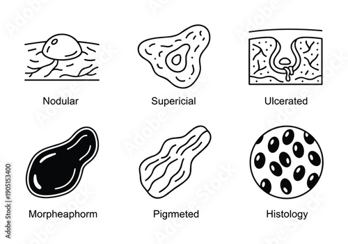 Skin Cancer Types Line Art Vector Illustration: Nodular, Superficial, Ulcerated, Morpheaphorm, Pigmented, Histology