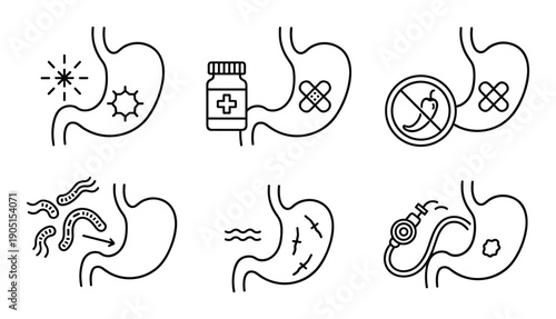 Stomach ulcer treatments and prevention methods icons, bacteria, medication, diet, surgery, healing