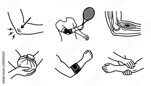 Tennis elbow treatment diagram with pain, brace, ice pack, and massage line art vector illustration