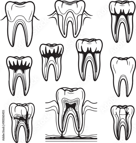 Set of human molar teeth cross section anatomical line drawings showing pulp chamber root canals enamel and dentin layers on background