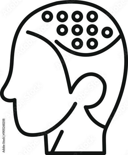 Human head showing areas marked for hair follicle transplantation, a medical aesthetic procedure