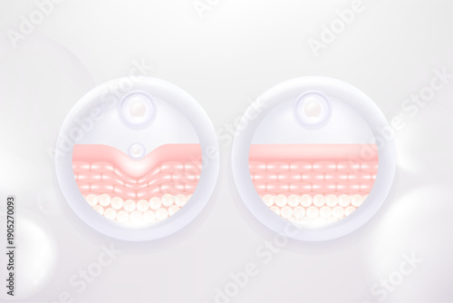 Hyaluronic acid and Niacinamide before and after skin solutions ad, pink collagen serum drops into skin cell with cosmetic advertising background ready to use, illustration vector.