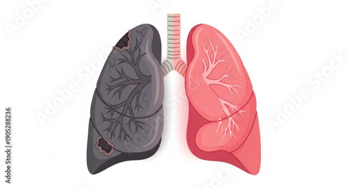Healthy versus diseased lungs with bronchial tree contrasting smoker and non smoker anatomy