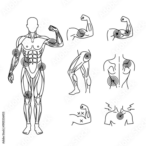 Outline myalgia icon black vector line art muscle pain set