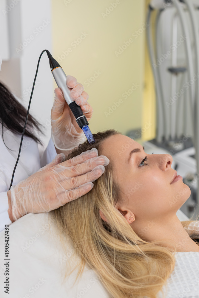 Fototapeta premium Alopecia. Woman hair loss treatment regeneration. Trichologist cosmetologist doctor applies vitamin serum injections from a syringe on head scalp dermapen fractional microneedle, clinic mesotherapy.