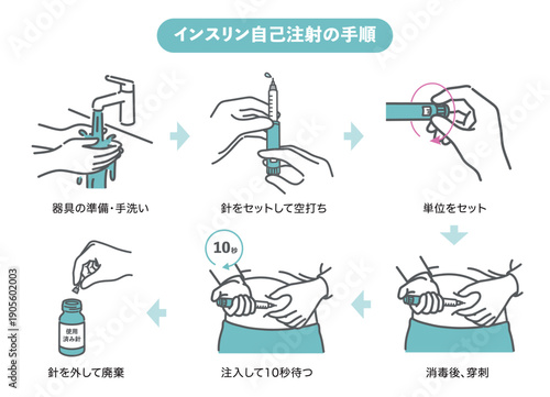 インスリン自己注射の手順・やり方イラスト図解（6ステップ）