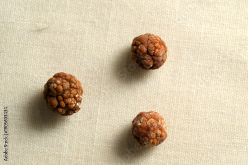 Gallstones removed from a human gallbladder