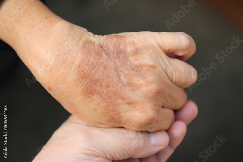 ging hands aging hands aging hands showing wrinkles and age spots, elderly hands, senior skin texture, aging process, healthcare and aging society concept
