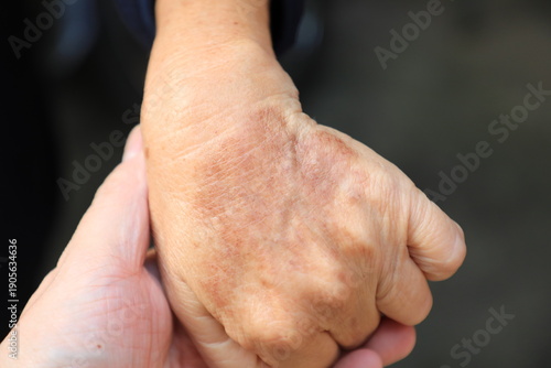 ging hands aging hands aging hands showing wrinkles and age spots, elderly hands, senior skin texture, aging process, healthcare and aging society concept