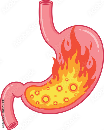 Human stomach with internal fire and acid reflux vector illustration isolated on white background, 