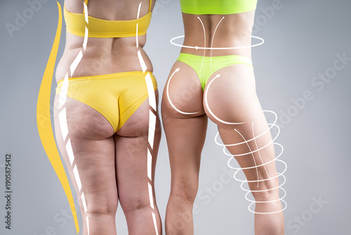 Buttocks with cellulite vs smooth skin, slim and overweight woman body with love handles comparison, before and after