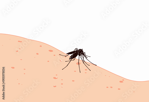 Detailed Illustration of a Mosquito Biting Human Skin Highlighting the Insect's Feeding Process and Potential Impacts