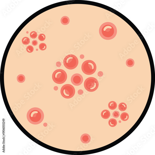 Skin rash and inflammatory skin condition, medical vector illustration