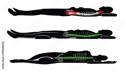 Ergonomic sleeping habits diagram for healthy spine with pillow support under knees and between legs.