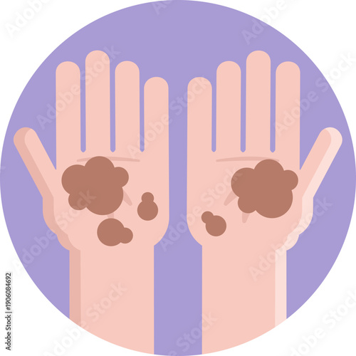 An icon showing unclean hands, indicating a potential source of food contamination due to poor hand hygiene.