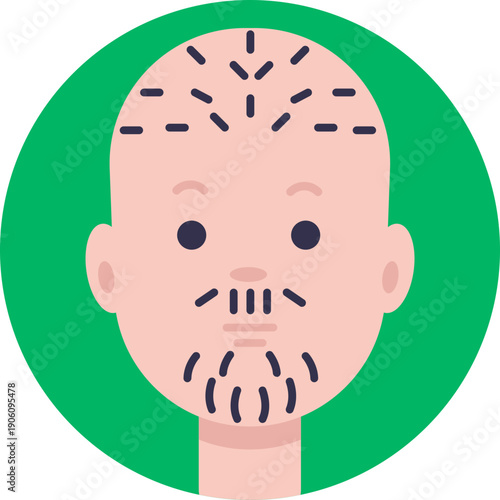 An icon representing unwanted facial hair, commonly used to indicate facial hair removal or grooming treatments.