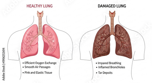 Healthy vs damaged lungs comparison human anatomy illustration
