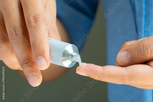 Hand of woman squeezing muscle rub cream from tube onto finger, analgesic ointment for pain relief, sports massage and physical therapy concept