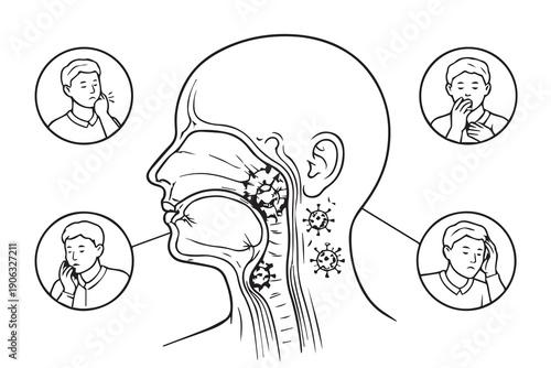 An educational vector illustration explaining nasopharyngeal cancer, showing the nasal and throat area anatomy with labels, designed to raise awareness, medical education, and early detection.