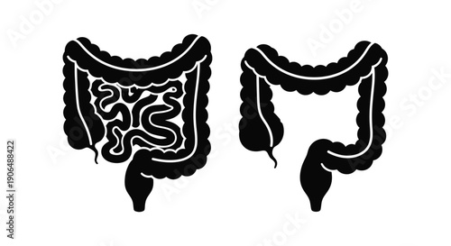 Anatomical illustration of two human intestinal tracts in black silhouette