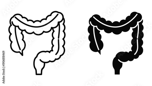 Colon anatomy diagram