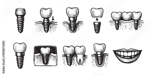 Black and white sketch illustration of various dental prosthetics including implants, dentures, bridges, and a full set of teeth in a glass. Use for dental, medical concepts.
