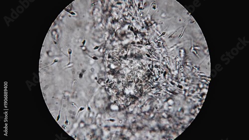 Real footage of human sperm under a light microscope 100x fertilizing an egg cell moving fast 4K HQ 