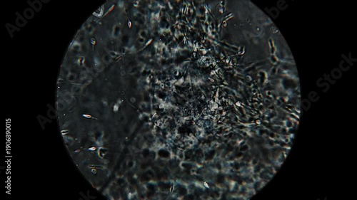 Real footage of human sperm under a light microscope 100x fertilizing an egg cell moving fast 4K HQ