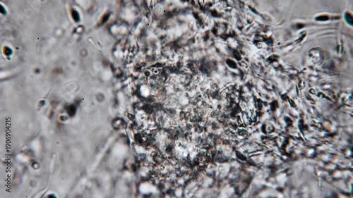 Real footage of human sperm under a light microscope 100x fertilizing an egg cell moving fast 4K HQ