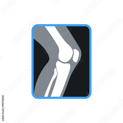 Medical X-ray style illustration of a human knee joint showing bones and joint structure. Suitable for healthcare, orthopedics, anatomy education, and medical presentations.
