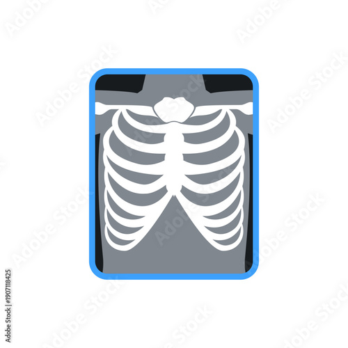 Chest X-ray illustration showing rib cage structure with simplified shading. Suitable for medical visuals, radiology concepts, anatomy learning, and healthcare design