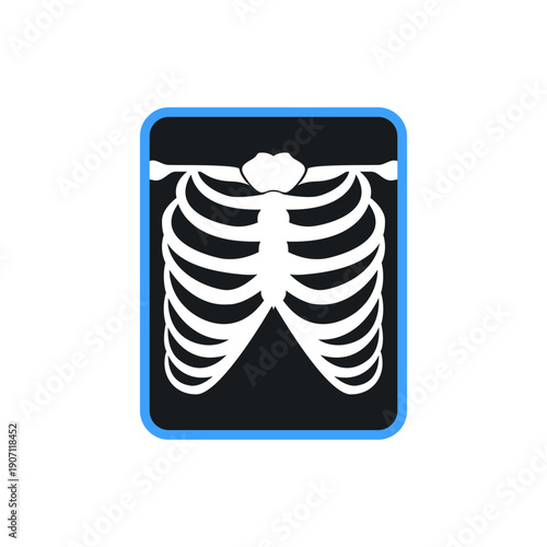 Chest X-ray illustration showing rib cage structure with simplified shading. Suitable for medical visuals, radiology concepts, anatomy learning, and healthcare design