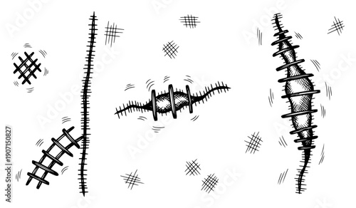 Set of various hand drawn medical stitches and surgical scar sketches