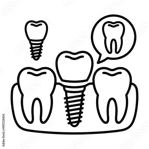 A simple black and white illustration of dental implants and healthy teeth.