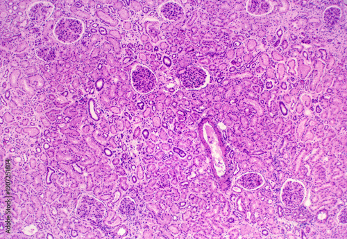 Photos Human kidney cortex
