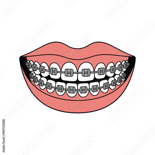 A cartoon illustration of a smiling mouth with orthodontic braces on its teeth.